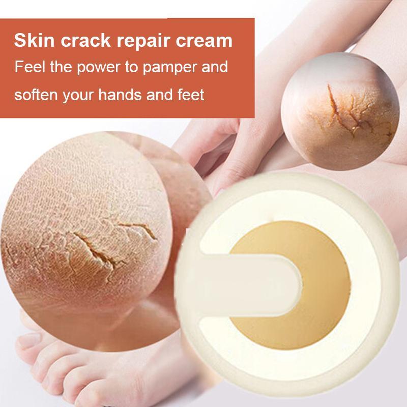 Anti-cracking Winter Cream